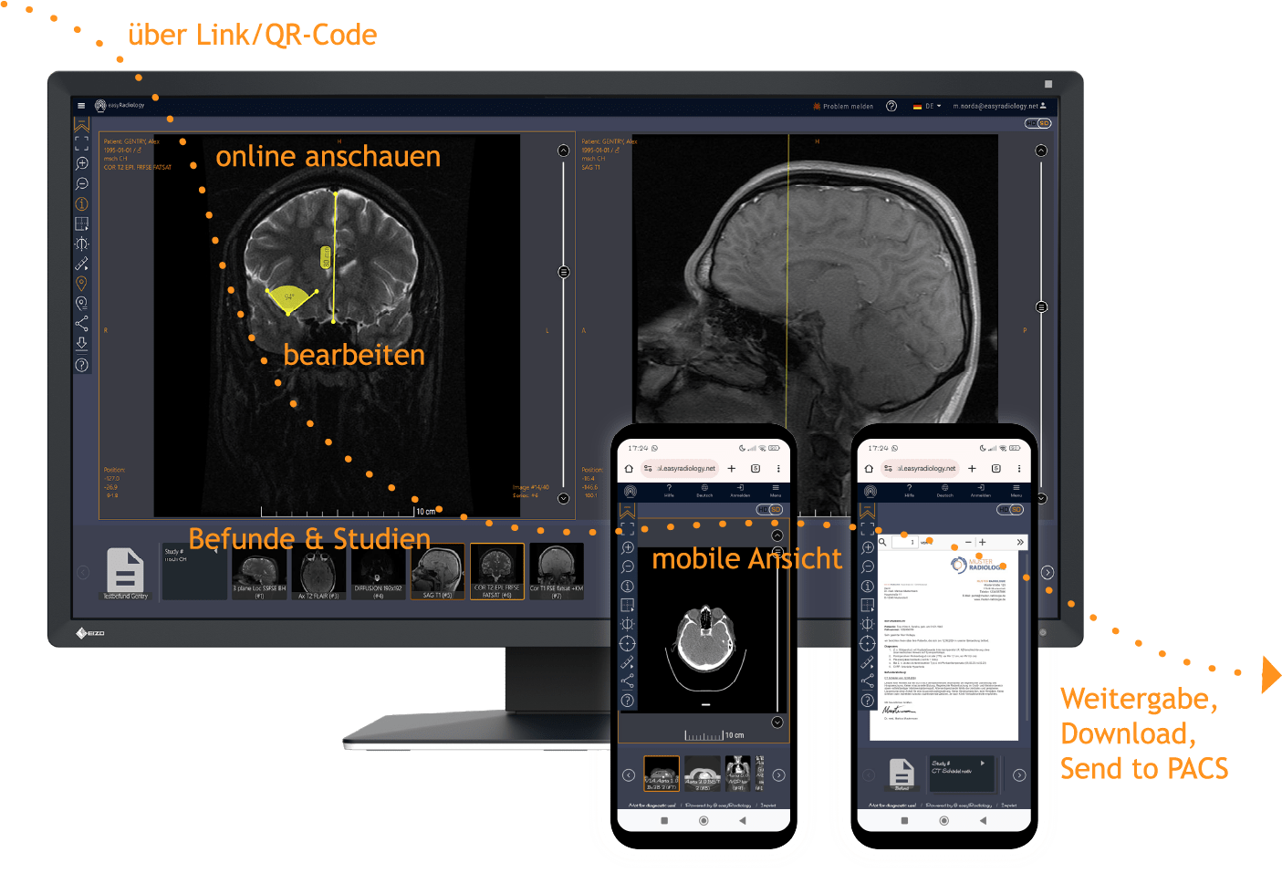 Patientenportal & Zuweiserportal Röntgenbild Darstellung im Web-Viewer für Patienten und Zuweiser
